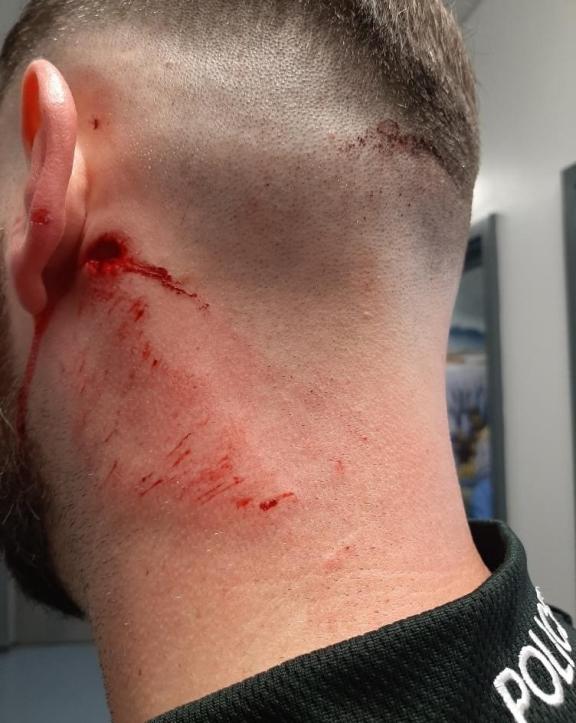 The officer injured by youths throwing bricks in the Distillery Court area off the Westlink.